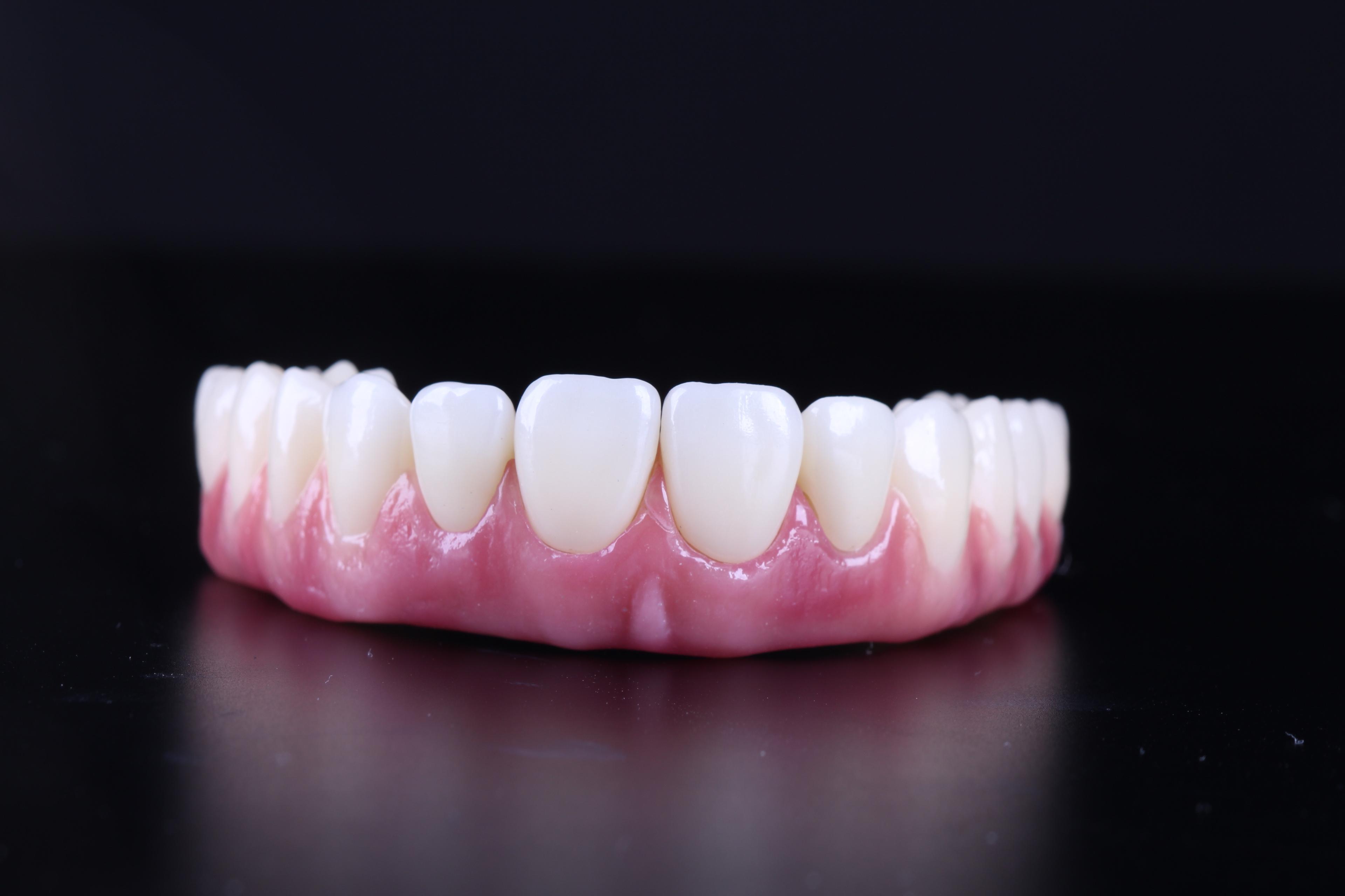 Próteses dentárias sobre uma mesa.